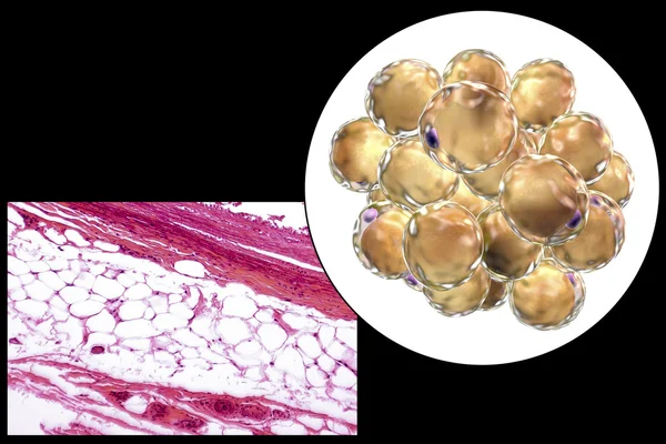 Fat cells, micrograph and 3D illustration — Stock Photo, Image