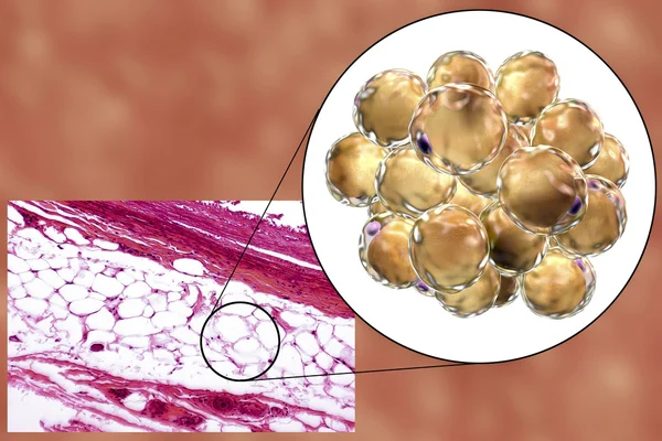 Fettzellen, Mikrographie und 3D-Illustration — Stockfoto