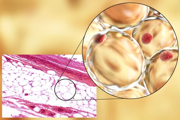 Fettzellen, Mikrographie und 3D-Illustration — Stockfoto