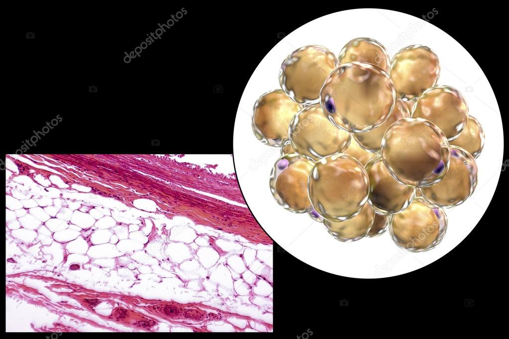 Fat cells, micrograph and 3D illustration