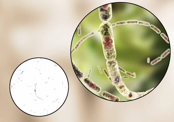 Bacillus anthracis, lehké mikrofotografie a ilustrace — Stock fotografie