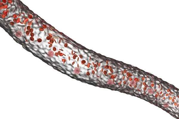 血管的流动的血液细胞 — 图库照片