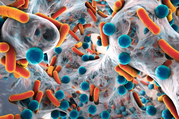 Biofilm av antibiotikaresistenta bakterier — Stockfoto