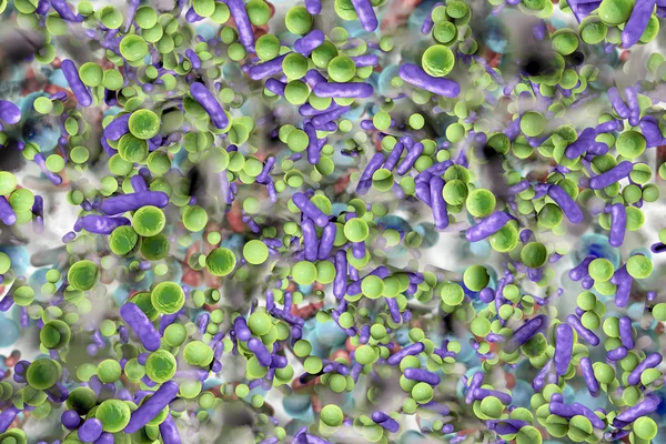 Biofilm av antibiotikaresistenta bakterier — Stockfoto