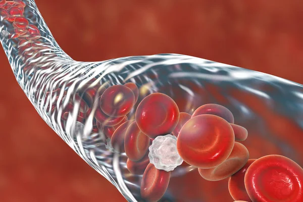 Céva s tekoucí erytrocyty a leukocyty — Stock fotografie