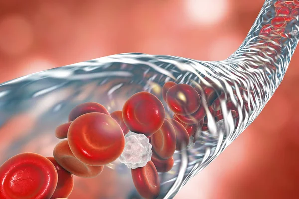 Vaisseau sanguin avec érythrocytes et leucocytes en circulation — Photo