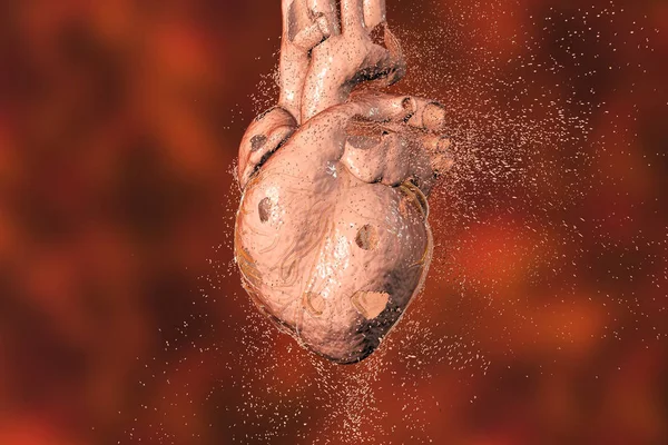 Концепция болезни сердца — стоковое фото