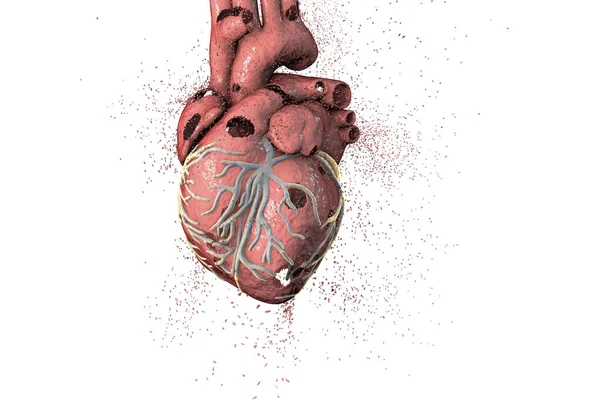 Έννοια των καρδιακών παθήσεων — Φωτογραφία Αρχείου