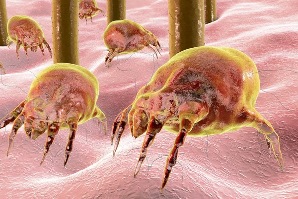 먼지 진드기 먼지와 가구에 살고 있는 Dermatophagoides — 스톡 사진