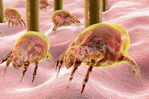 Dust mite Dermatophagoides which lives in dust and furniture