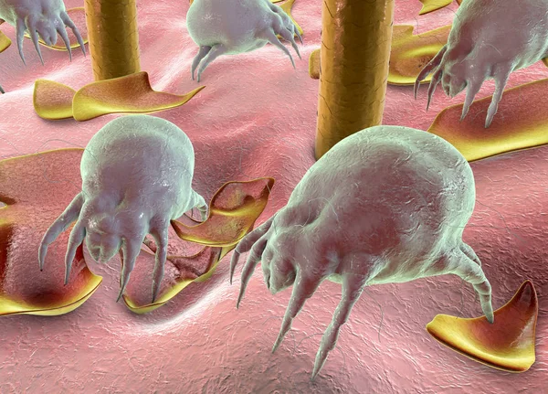 Dust mite Dermatophagoides which lives in dust and furniture — Stock Photo, Image