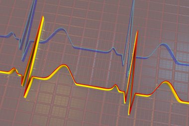 Elektrokardiyogram, EKG arka plan
