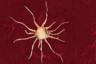 Kanser hücresi, tümör hücre