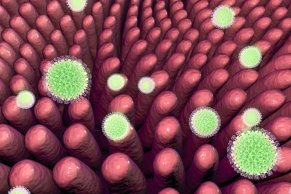 Rotaviruses 창 자 감염 — 스톡 사진