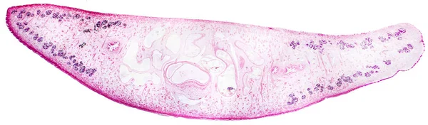 간 흡 충 Fasciola hepatica의 가벼운 현미경 사진 — 스톡 사진