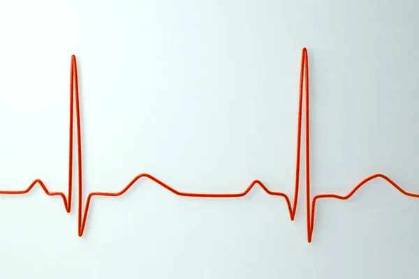 Elektrocardiogram op lichte achtergrond — Stockfoto