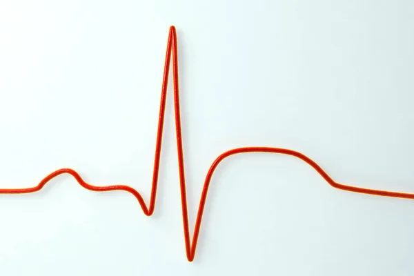 ECG in infarto miocardico, illustrazione che mostra l'elevazione ST, immagine non marcata — Foto Stock
