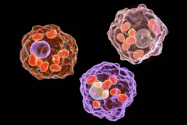 Leishmania amastigotes 감염 된 대 식 세포 — 스톡 사진