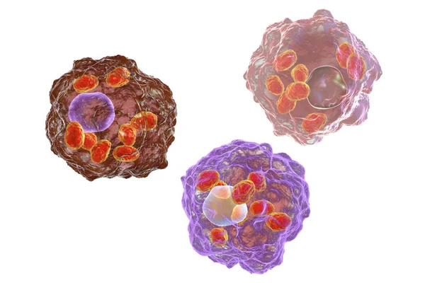 Leishmania amastigotes macrófagos infectados —  Fotos de Stock