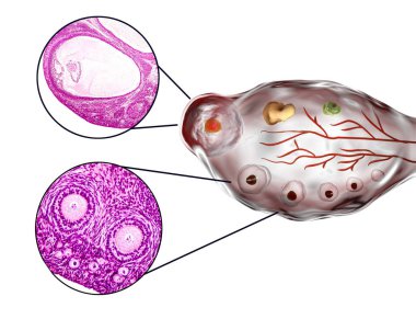 Bir yumurtalık enine bölümü