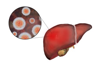 Karaciğer Hepatit C virüsü, hepatit C enfeksiyonu ve yakın çekim Manzaralı