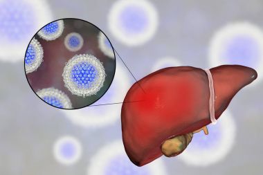 Karaciğer Hepatit C virüsü, hepatit C enfeksiyonu ve yakın çekim Manzaralı