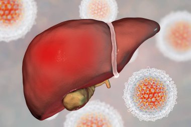 Liver with Hepatitis C infection and close-up view of Hepatitis C Virus clipart