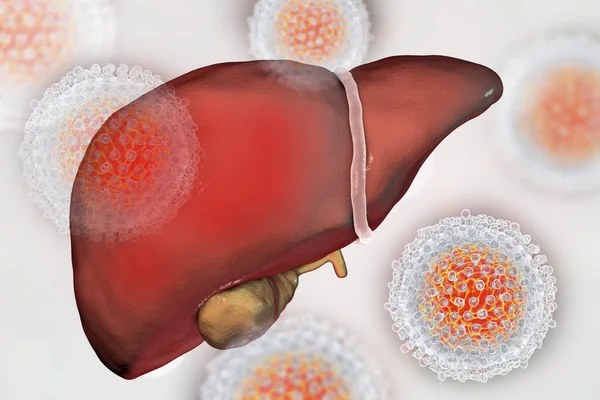 Liver with Hepatitis C infection and close-up view of Hepatitis C Virus