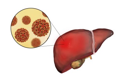 Karaciğer Hepatit B virüsü, hepatit B enfeksiyonu ve yakın çekim Manzaralı