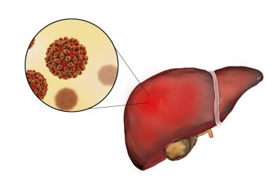 Karaciğer Hepatit B virüsü, hepatit B enfeksiyonu ve yakın çekim Manzaralı
