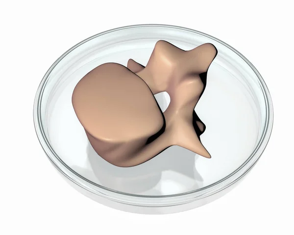 Bioprinted vertebra in Petri dish — Stock Photo, Image