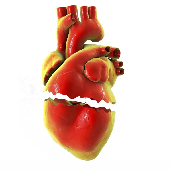 Realistico cuore spezzato, separazione e divorzio concetto — Foto Stock