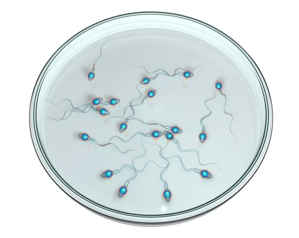 Espermatozoides en placa Petri, concepto de fertilización artificial — Foto de Stock