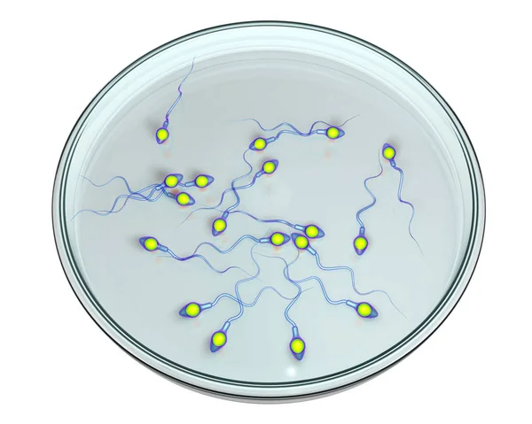 Spermatozoans, Petri-csészében, mesterséges megtermékenyítés koncepció — Stock Fotó
