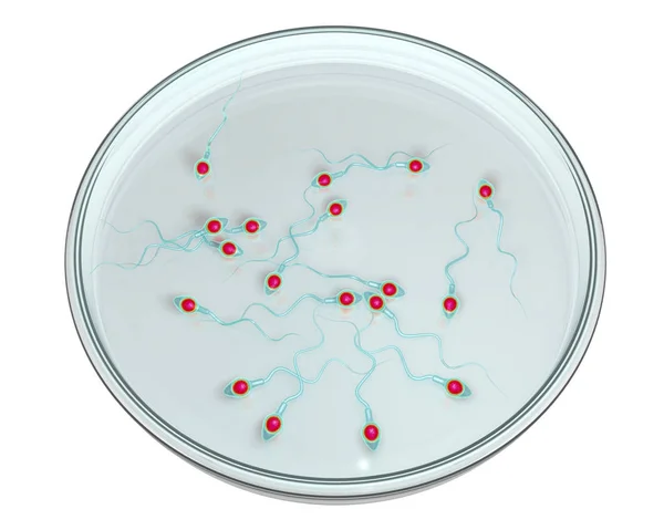 Spermatozoários em placa de Petri, conceito de fertilização artificial — Fotografia de Stock