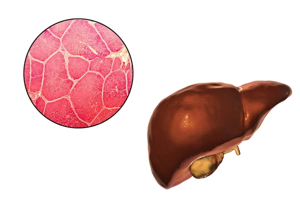Ilustracja wątroby i mikrogram — Zdjęcie stockowe