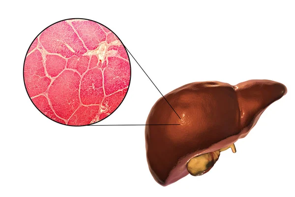 Lever illustration och Mikrograf — Stockfoto