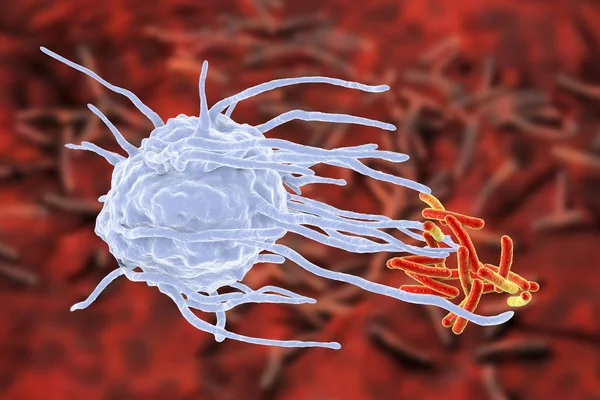 Macrophage engulfing tuberculosis bacteria