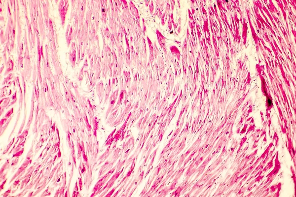 Kalp hipertrofisi photomicrograph