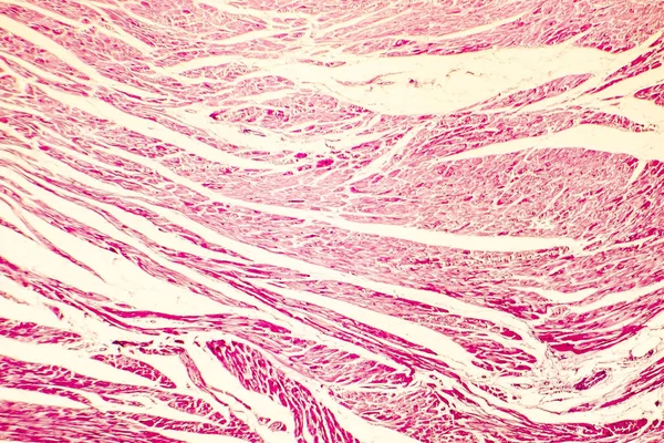 Kalp hipertrofisi photomicrograph