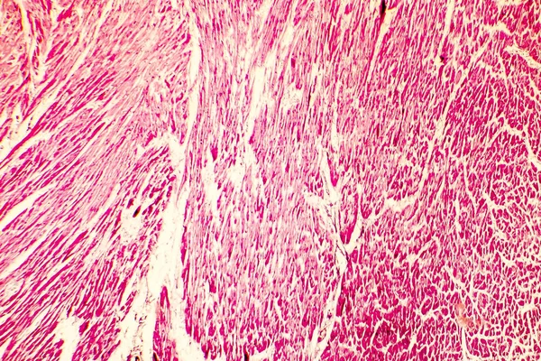 Heart hypertrophy photomicrograph — Stock Photo, Image