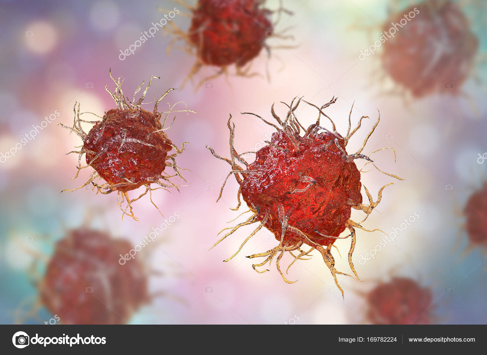 Steve gschmeissner cell. раковые клетки под микроскопом. злокачественная опухоль. удаленные раковые клетки. раковые клетки под микросокп.