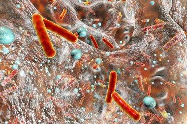 Antibiotic resistant bacteria inside a biofilm clipart