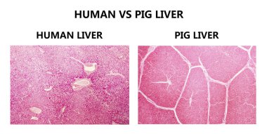 İnsan ve domuz karaciğer