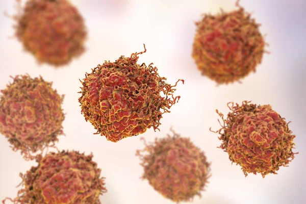Prosztata rákos sejteket — Stock Fotó