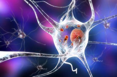 Parkinson hastalığı nöronlarda