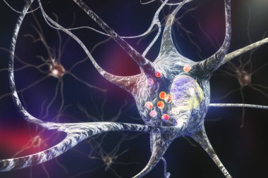Neurons in Parkinson's disease clipart