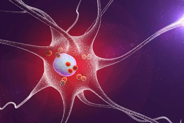 Neurons in Parkinson's disease Stock Image