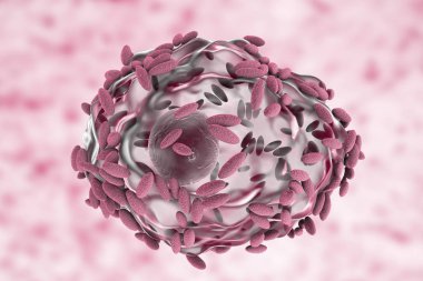 Bakteriyel vaginosis mikroskobik tanısında. Epitel hücre, sözde ipucu hücre Gardnerella Vajinalis bakteri ile kaplıdır