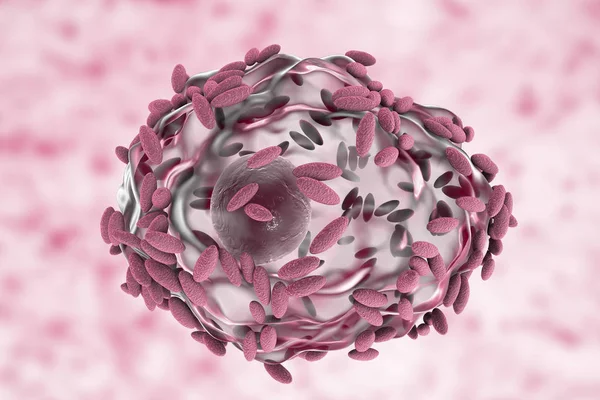 Μικροσκοπική διάγνωση της βακτηριακής κολπίτιδας. Επιθηλιακών κυττάρων, κυττάρων αποκαλούμενος ένδειξη καλύπτεται με βακτήρια Gardnerella vaginalis — Φωτογραφία Αρχείου